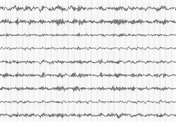 Hilt Consulting. EEG, EEG Biofeedback. Drożdżyk B., Bielawa godziny otwarcia