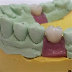 Korona-Dental Sc. Pracownia Techniki Dentystycznej, Wrocław godziny otwarcia