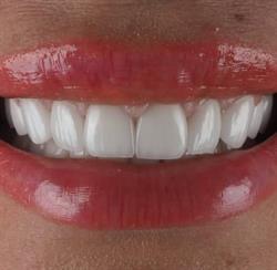 Otodent Smile, Warszawa godziny otwarcia